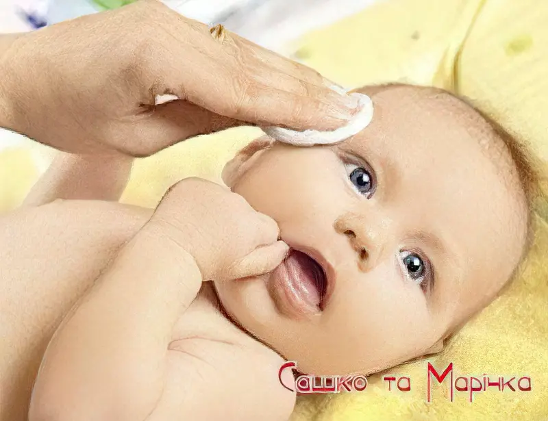 1420707409 skin care baby