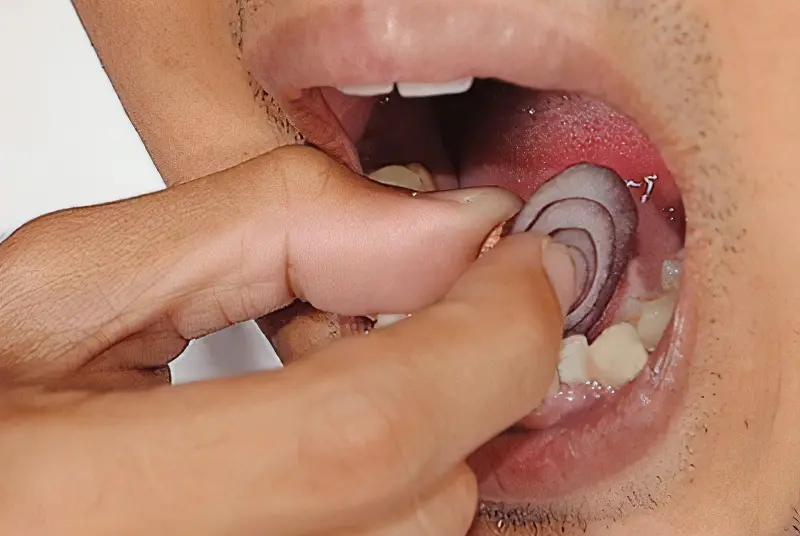 Використання часнику і цибулі в домашніх умовах, коли болить зуб