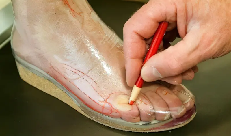 Зняття мірок для виготовлення ортопедичного взуття